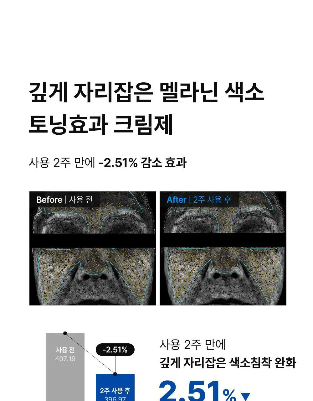 [멜라닌양개선] 동아제약 색소침착 프로 크림제 40ml 상세페이지 11